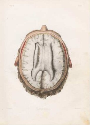 Neurologie (Aufbau einer der Bestandteile des Corpus callosum)
