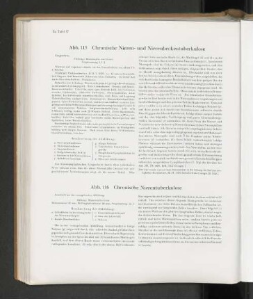 Abb. 115 Chronische Nieren- und Nierenbeckentuberkulose