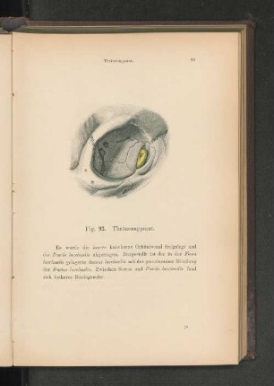 Fig. 93. Thränenapparat.