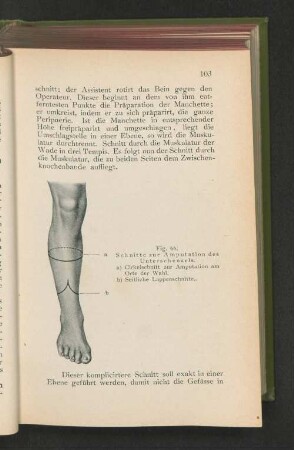 Fig. 66. Schnitte zur Amputation des Unterschenkels.