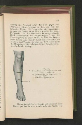 Fig. 66. Schnitte zur Amputation des Unterschenkels.