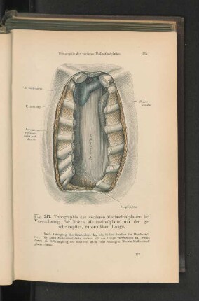 Fig. 247. Topographie der vorderen Mediastinalplatte.