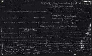 [Graphical recordings: pulse]