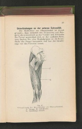 Fig. 47. Gruppirung der Muskulatur am Oberschenkel.