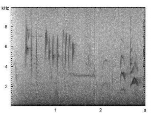 Star | Sturnus vulgaris - Gesang