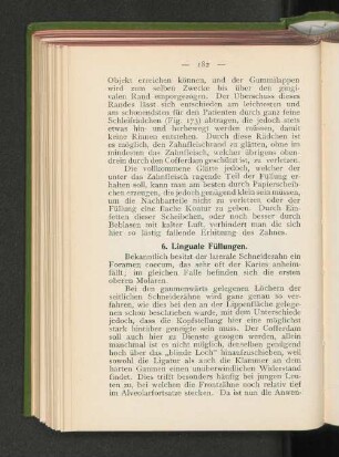 6. Linguale Füllungen.