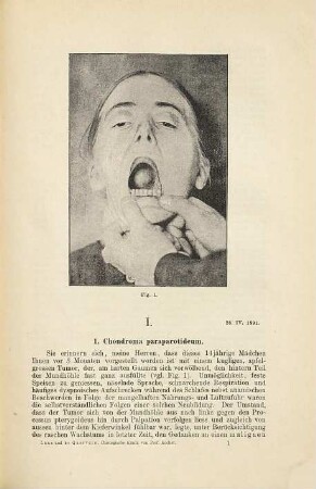 Chirurgische Klinik von Prof. Kocher in Bern : Sommer-Semester 1891