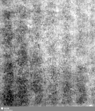 Lilienschild (gekrönt) / JER? = S.147/148