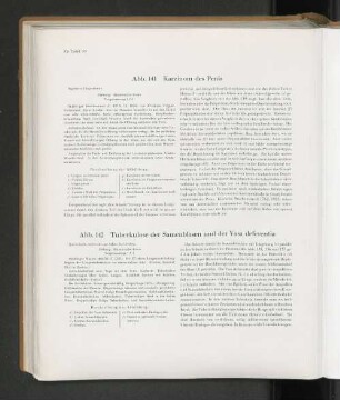 Abb. 141 Karzinom des Penis
