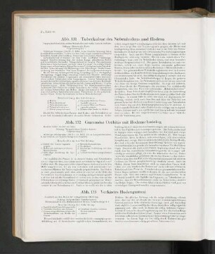 Abb. 131 Tuberkulose des Nebenhodens und Hodens