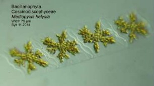 Mediopyxis helysia Sylt 2014