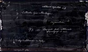 [Graphical recordings: pulse]