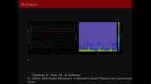 Fundamentals of EEG based Brain-Computer Interfaces