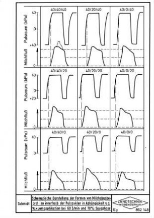 Schematische Darstellung der Formen von Milchabgabeprofilen innerhalb der Pulszyklen in Abhängigkeit von der Vakuumapplikation bei 60 Z/min und 70 % Saugphase