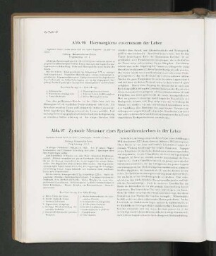 Abb. 96 Haemangioma cavernosum der Leber