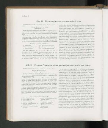 Abb. 96 Haemangioma cavernosum der Leber