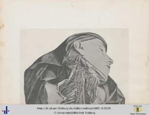 Figura XXXXIII.