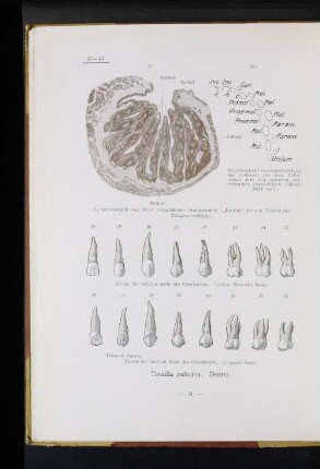 Tonsilla palatina. Dentes.
