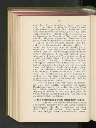 3. Die Behandlung partiell entzündeter Pulpen.