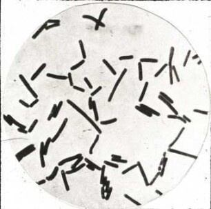 Clostridium perfringens, Kulturbild 1:1000