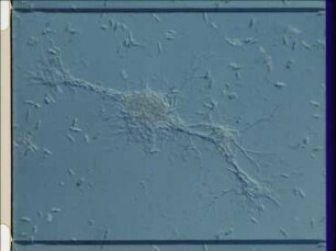 The Change of Phases of Thalassomyxa australis (Promycetozoida)