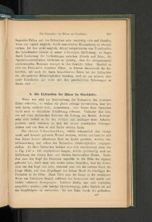 3. Die Extraction der Zähne im Oberkiefer.