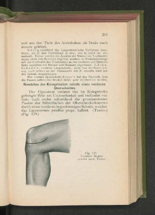 Fig. 129. Vorderer Bogenschnitt nach Textor.
