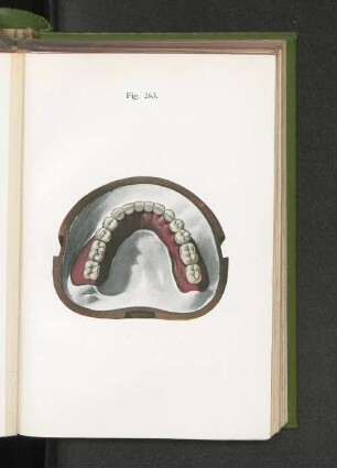 Fig. 263.