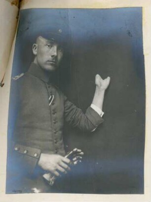 Foto eines an den Fingern der linken Hand amputierten, aber die Handfläche gestreckt haltenden Soldaten im Kngl. Reservelazarett in Singen