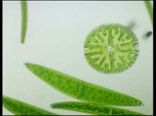 Chloroplastenformen bei Zieralgen