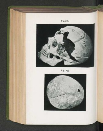 Fig. 136. Fig. 137.