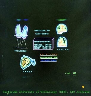 Digitale Darstellung von Szintigrammen in der Abteilung Datenverarbeitung und Instrumentierung (ADI)