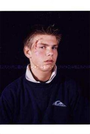 Junger Mann mit geschminkter Gesichtsverletzung (Zusätzlich eingereichtes Foto zum Sonderthema: Ein Bild von mir - Selbstporträts und Selbstdarstellungen)