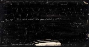 [Graphical recordings: respiration]
