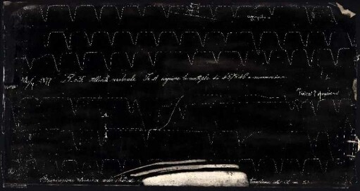 [Graphical recordings: respiration]
