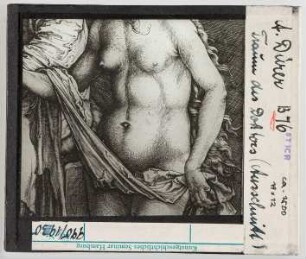 Albrecht Dürer: Traum des Doktors, Detail