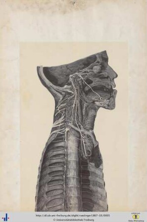 Figura XXXXIV.