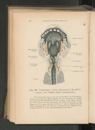 Fig. 169. Gaumensegel, hintere Rachenwand, Mundhöhle, Larynx und Trachea frontal durchschnitten.