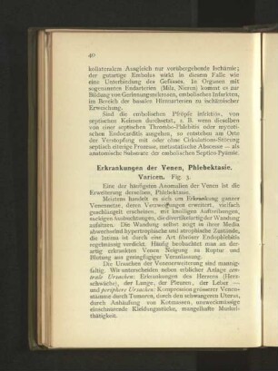Erkrankungen der Venen, Phlebekastie.