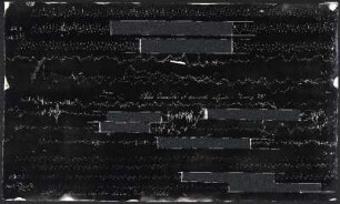 [Graphical recordings: pulse]