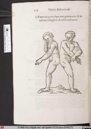 Foetus in parte superiori geminatus, & in inferiori simplex clunibus cohaerens.
