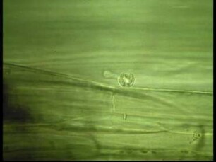 Phytophthora infestans als Erreger der Kraut- und Knollenfäule