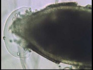 Life History of the Cyst Nematode Heterodera schachtii