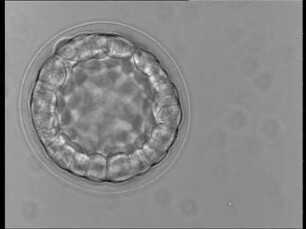 Development in the Sea Urchin (Psammechinus miliaris) - 1. Fertilization and Cleavage