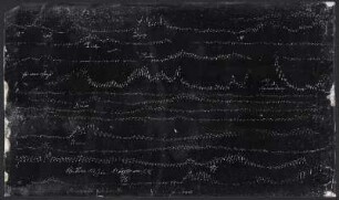 [Graphical recordings: pulse]