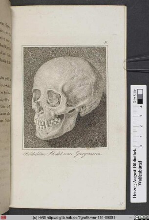 Bildschöner Schedel einer Georgianerin.
