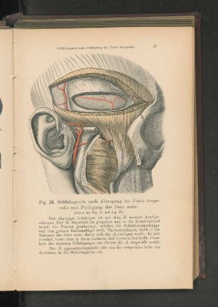 Fig. 36. Schläfengrube nach Abtragung der Fascia temporalis und Freilegung der Dura mater.
