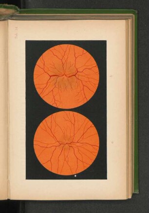 Tab. 14.