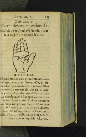 Observatio 7. Manus dextra cujusdam Tibicinis de capitati, ob ...