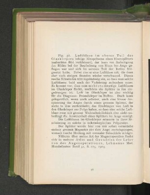Fig. 56. Luftblase im oberen Teil des Glaskörpers.